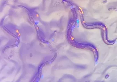 a close-up photo of C. elegans worms a close-up photo of C. elegans worms